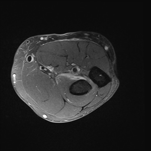 Click on the Serie image to view the images of Wieszt, Gnter